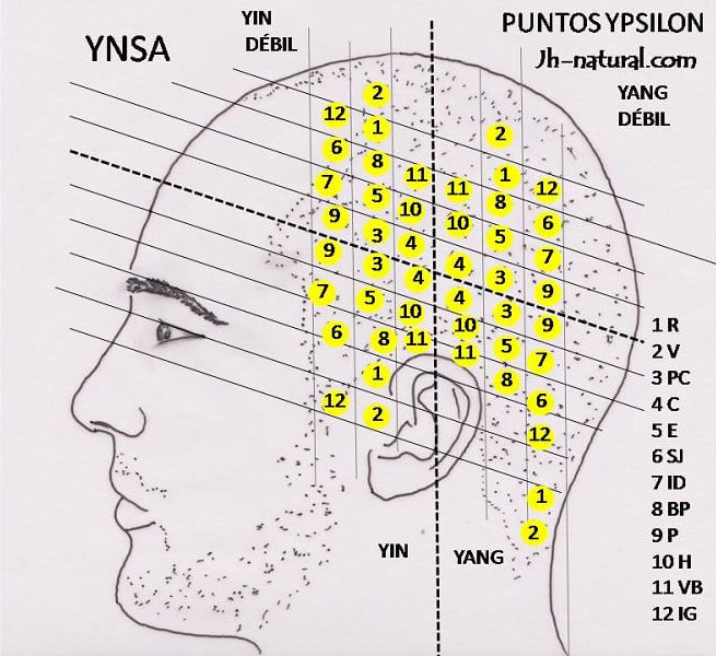 Puntos Ypsilon