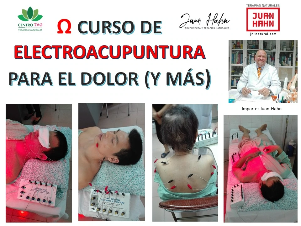 Curso de Electroacupuntura para el dolor y más