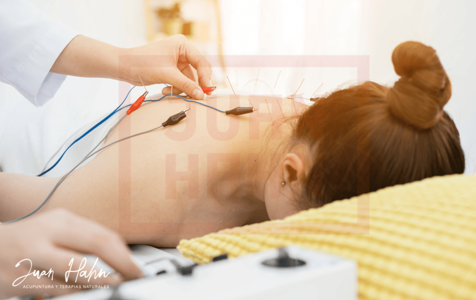 Electroacupuntura - Curso Online - Imagen 07
