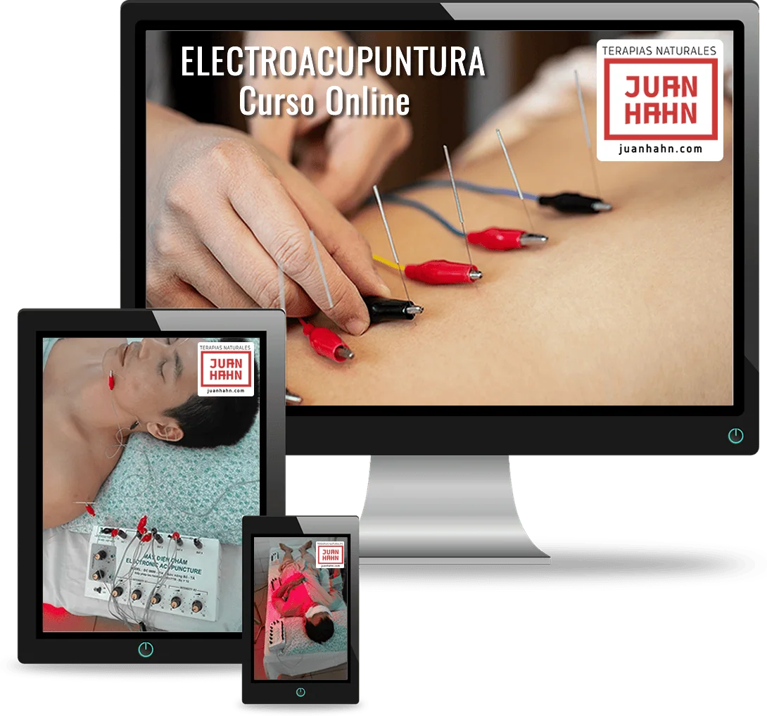 Electroacupuntura - Curso Online - Imagen header