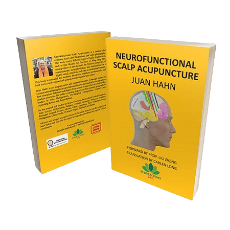 Neurofunctional Scalp Acupuncture Book - Hemepage image