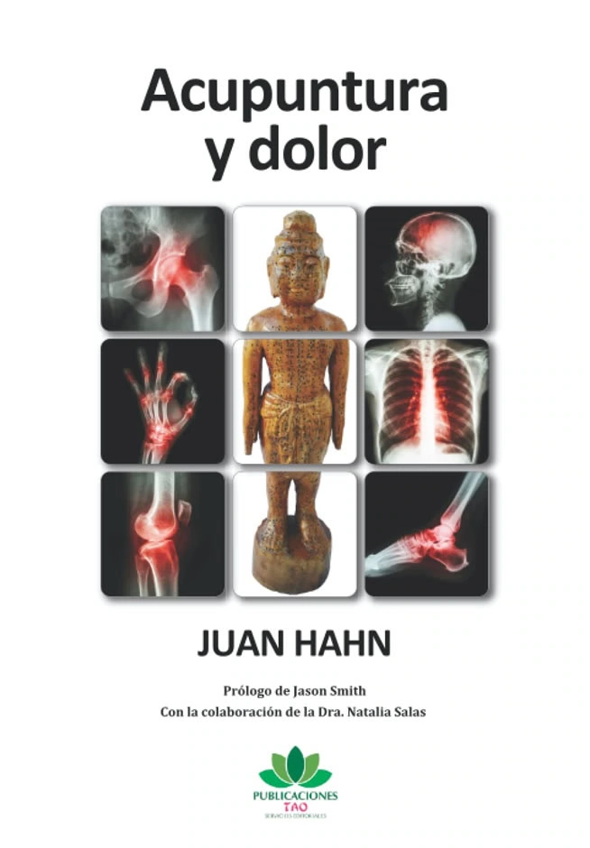 Acupuntura y Dolor - Juan Hahn - Libro portada