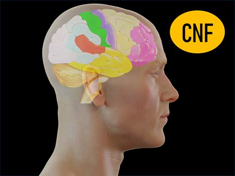 Icono Craneopuntura Neurofuncional