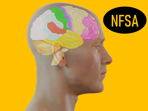 Icono Neurofunctional Scalp Acupuncture