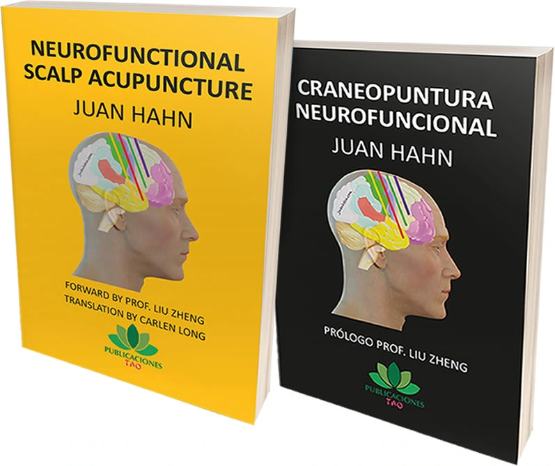 Neurofuntional Scalp Acupuncture - English and Spanish books